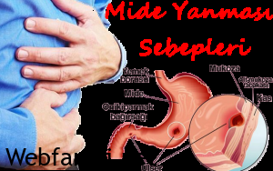 mide yanması