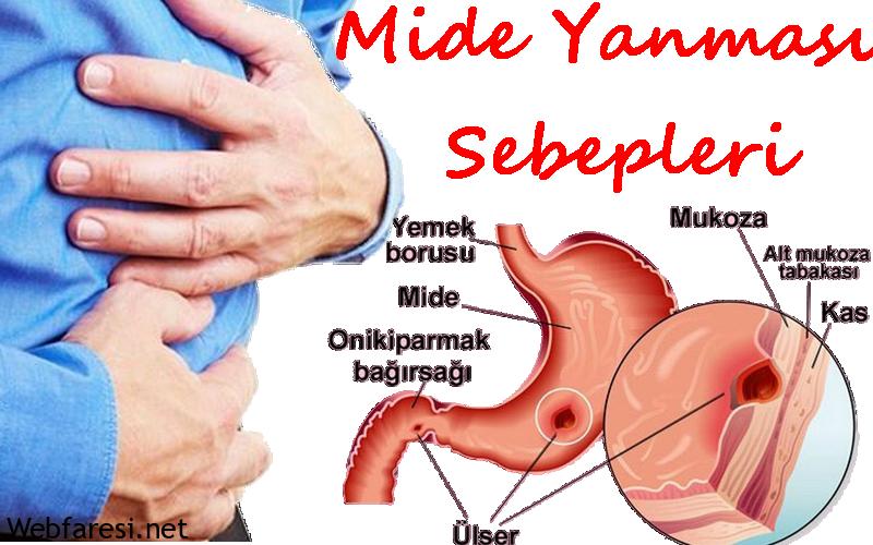 mide yanması